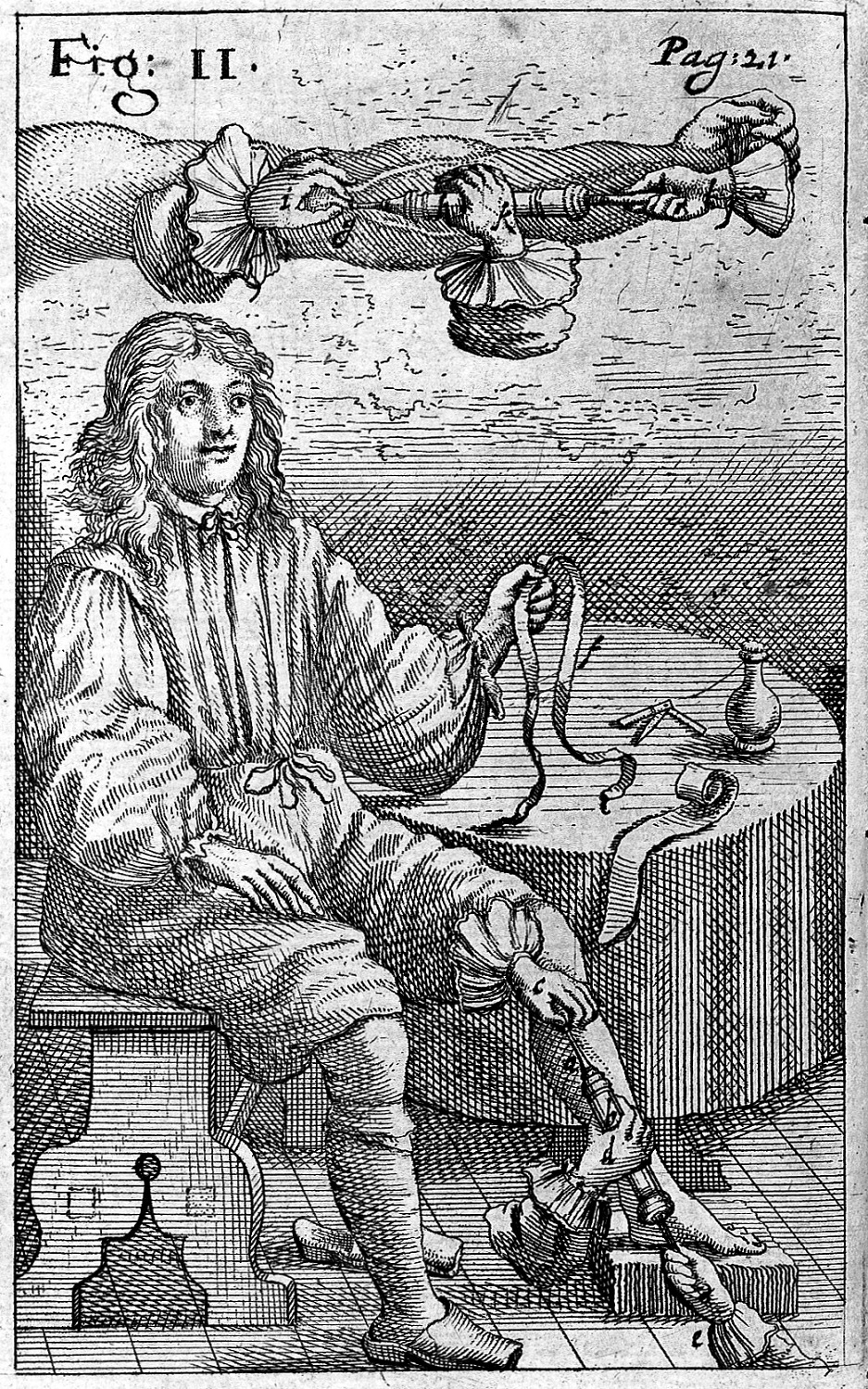 Stara rycina przedstawia młodego mężczyznę ubranego w strój historyczny siedzącego na krześle,  obok okrągłego stołu na którym znajdują się różne przedmioty. Nad mężczyzną rysunek ręki, która jest przecięta i do której wkłuwa się igła. Jedna z nóg mężczyzny oparta jest na klocku. Widzimy dwie ręce, które trzymają strzykawkę z igłą i wkłuwają się w jego nogę. 